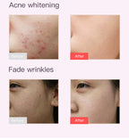 home use beauty device 7-color light facial mask customize your own beauty mask gift