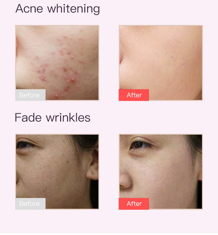 home use beauty device 7-color light facial mask customize your own beauty mask gift